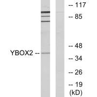 Anti-YBX2