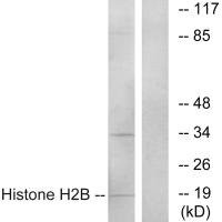 Anti-Histone H2B