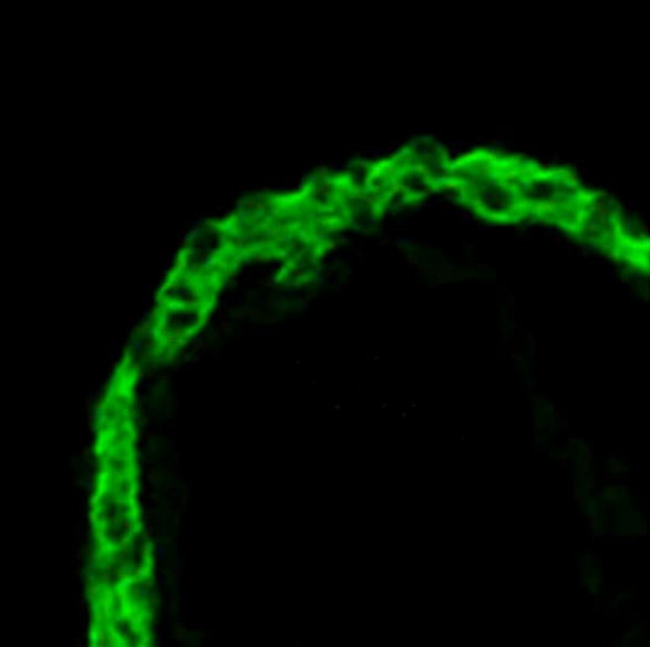 Anti-Cardiac Troponin T, clone 1C11