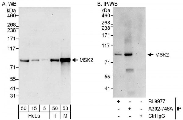 Anti-MSK2