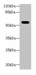 Anti-Aldh1a1