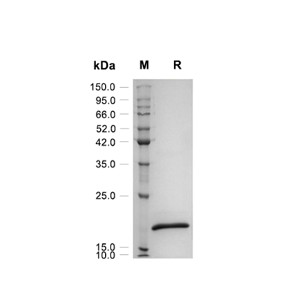 Glia Maturation Factor beta (GMFb) Recombinant (Human)