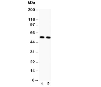 Anti-GLUT4 (Glucose Transporter 4)
