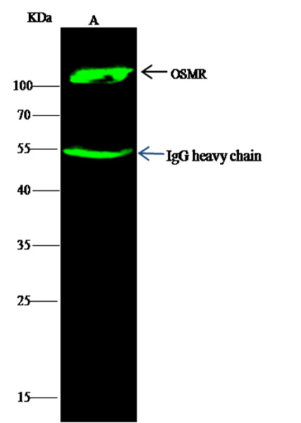 Anti-OSMR/IL31RB Monoclonal Antibody