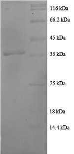 C-C motif chemokine 20 (CCL20), partial, human, recombinant