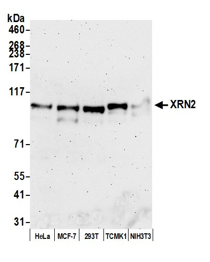 Anti-XRN2