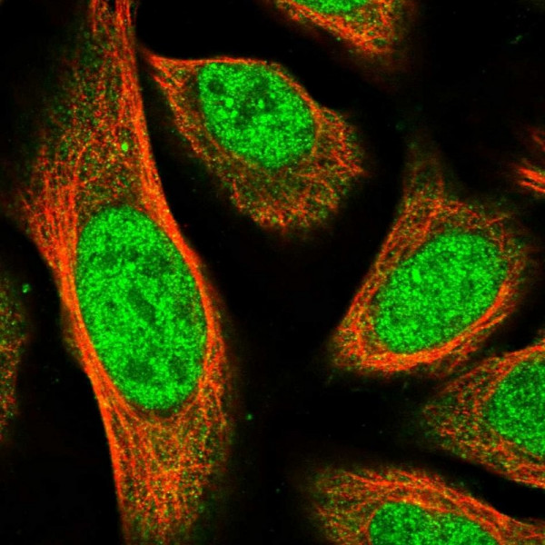 Anti-MPP3