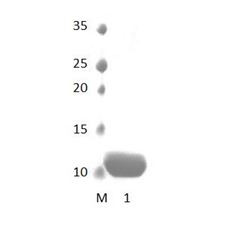 APBA1_1 PDZ Domain