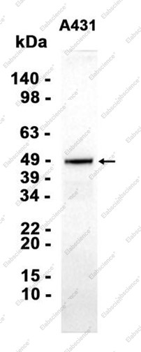 Anti-Recombinant HDAC3, clone C112825