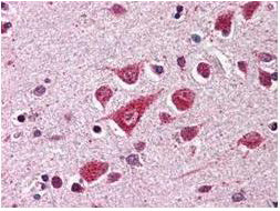 Anti-Protective Protein/Cathepsin A