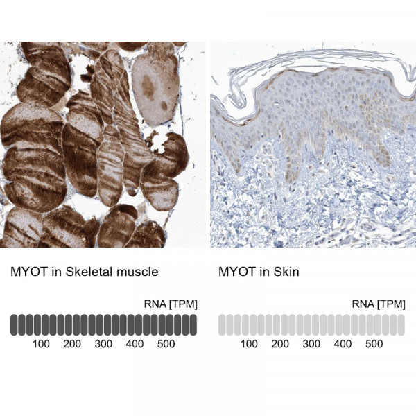 Anti-MYOT
