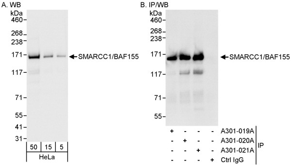 Anti-SMARCC1/BAF155