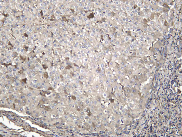 Anti-Recombinant FA10, clone C112587