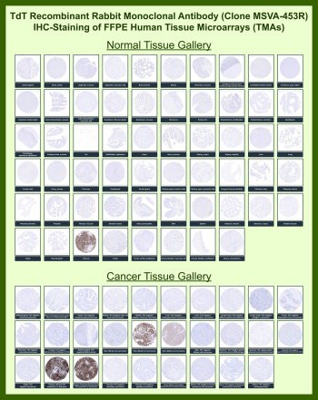 Anti-TdT / DNA nucleotidylexotransferase, clone MSVA-453R