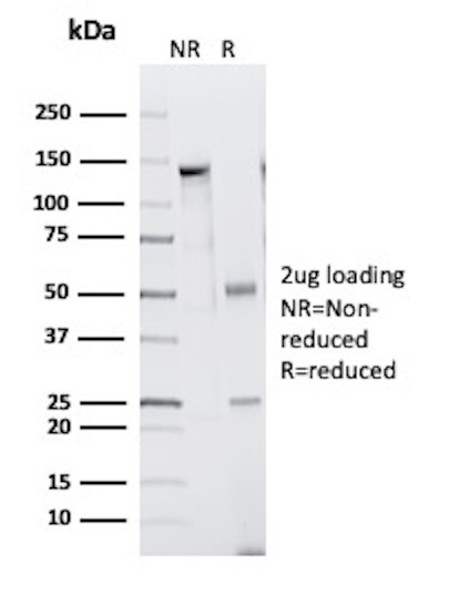 Anti-CD33 / SIGLEC3 (Myeloid Cell Surface Antigen), clone WM53