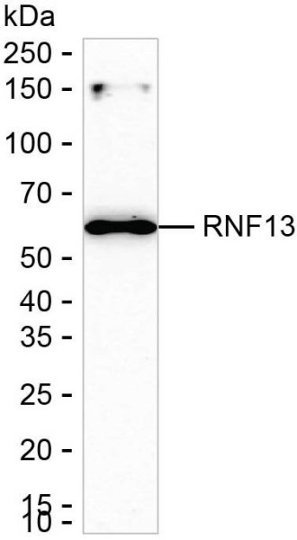 Anti-RNF13