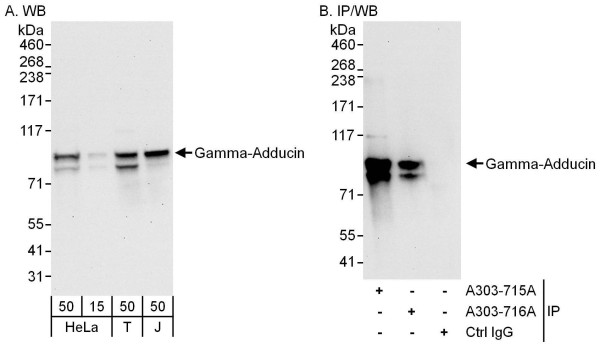 Anti-Gamma-Adducin
