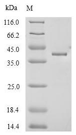 Anthrax toxin receptor 1 (Antxr1), partial, mouse, recombinant