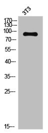 Anti-NTRK2