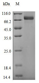 UL16-binding protein 1 (ULBP1), Biotinylated (Active), human, recombinant