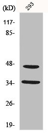 Anti-FOXB1/FOXB2
