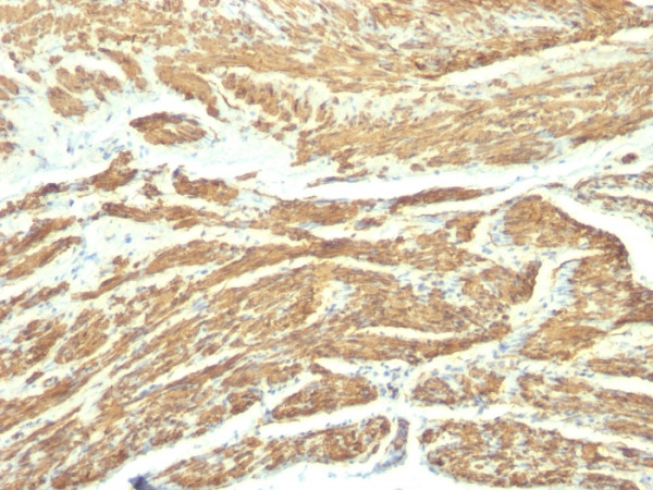Anti-Caldesmon, HMW (h-Caldesmon) (Smooth Muscle Marker), clone SPM168