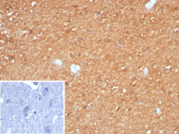 Anti-CKB / Creatine kinase B, clone CKBB/8295R