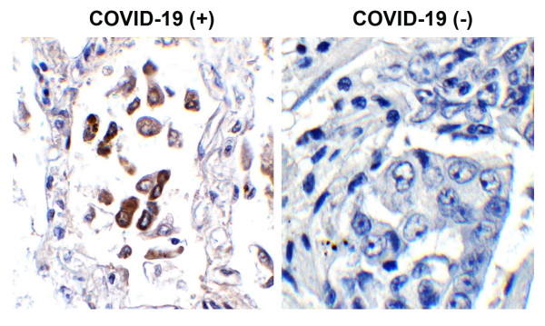 Anti-SARS-CoV-2 ORF8