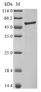 Nucleoprotein (N), Bovine coronavirus, recombinant