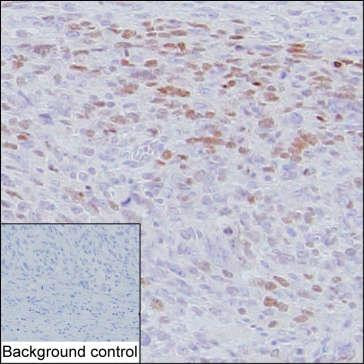 Anti-Myoblast Determination Protein 1