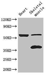 Anti-IQCG