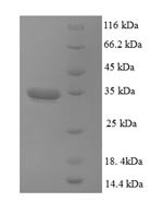 Dynactin subunit 3 (DCTN3), human, recombinant