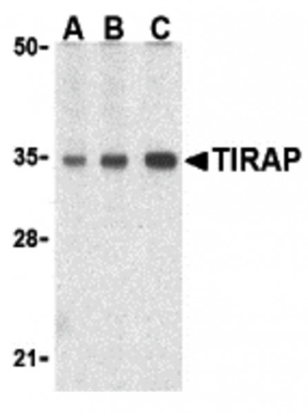 Anti-TIRAP