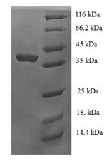 Upstream stimulatory factor 1 (USF1), partial, human, recombinant