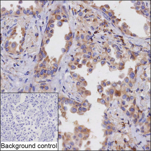 Anti-PTGDS Recombinant