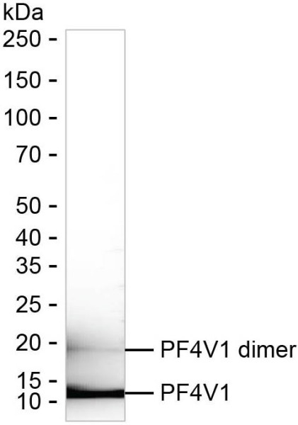 Anti-PF4V1