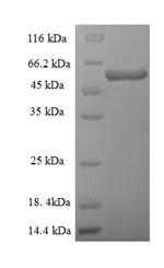 Threonine--tRNA ligase, mitochondrial (TARS2),partial, human, recombinant