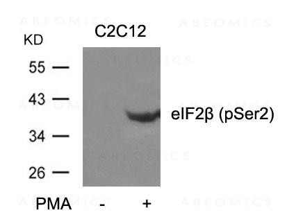 Anti-eIF2beta (phospho-Ser2)