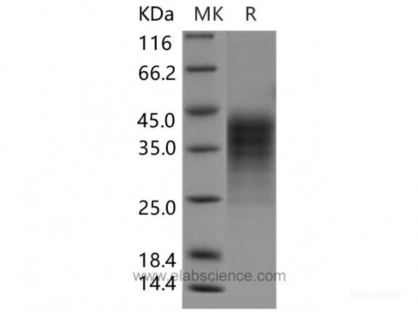 LIF Protein (His Tag) (recombinant human)