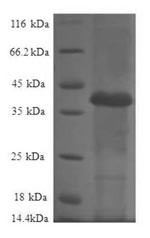 60S ribosomal protein L36a-like (RPL36AL), human, recombinant