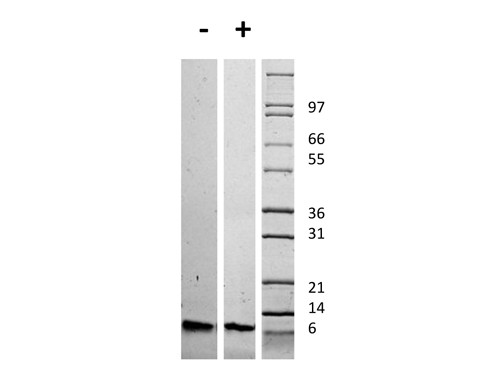 Insulin-like Growth Factor I