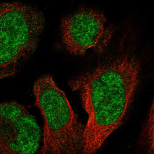 Anti-PBXIP1