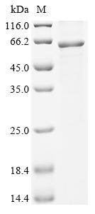 Thioredoxin-interacting protein (TXNIP),Escherichia Coli, human, recombinant