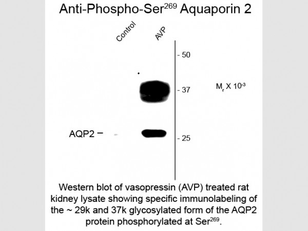 Anti-phospho-Aquaporin 2 (Ser269)