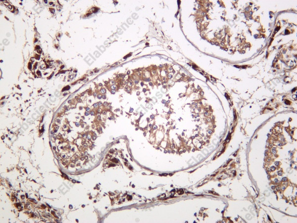 Anti-Recombinant VHR, clone C112230
