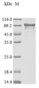 La-related protein 6 (LARP6), human, recombinant