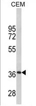 Anti-Myelin Protein zero