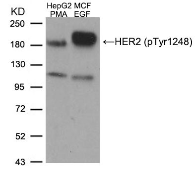 Anti-phospho-HER2 / ErbB2 (Tyr1248)