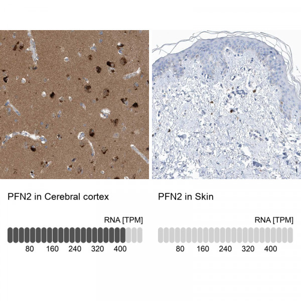 Anti-PFN2