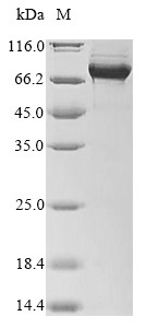 Nuclear body protein SP140-like protein (SP140L), human, recombinant